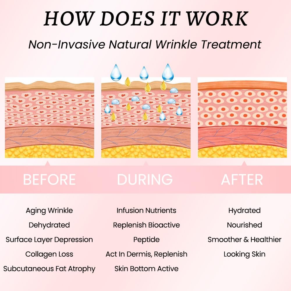 Kaely 128 Pcs Wrinkle Patches for Face Overnight, Silicone Scar Tape for Wrinkles Forehead, Face Tape for Wrinkles Overnight Sleeping Lifting Sagging Skin, Smile Line Facial Smoothing