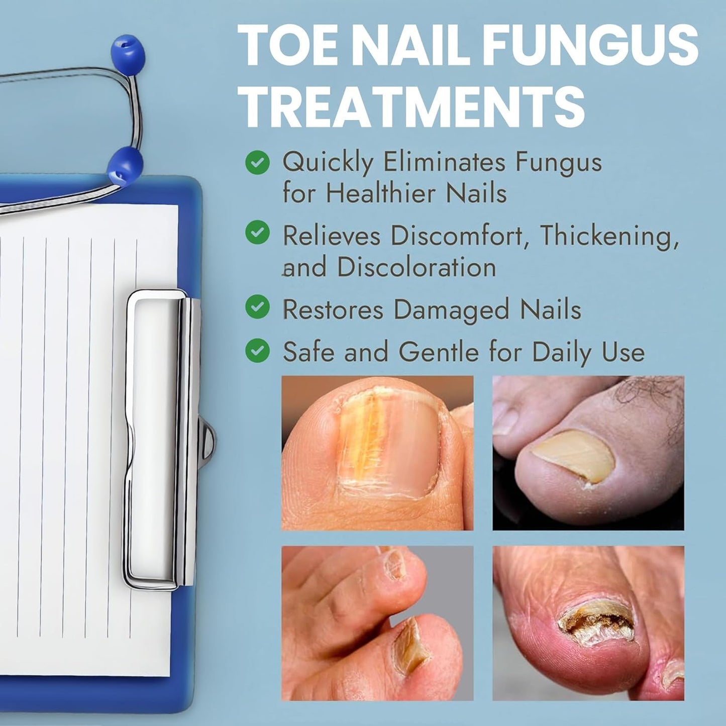 Nail Fungus Treatment Extra Strength for Toenail & Fingernails | Antifungal Nail Treatment with Tea Tree Oil | Fast-Acting, No-Touch Applicator | Restores Thickness & Discoloration | 20g