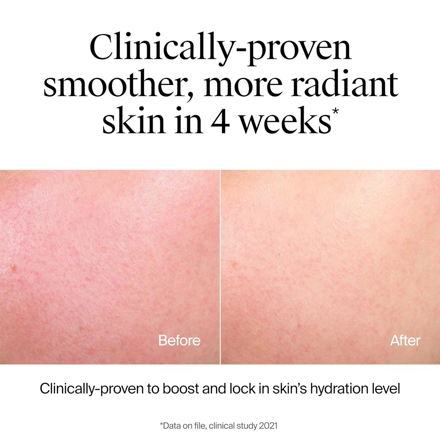 Neutrogena Hydro Boost Face Wash, Fragrance Free, Hydrating Facial Cleanser with Hyaluronic Acid, Daily Foaming Face Wash & Makeup Remover, Hypoallergenic Gel Cleanser, 7.8 fl. oz