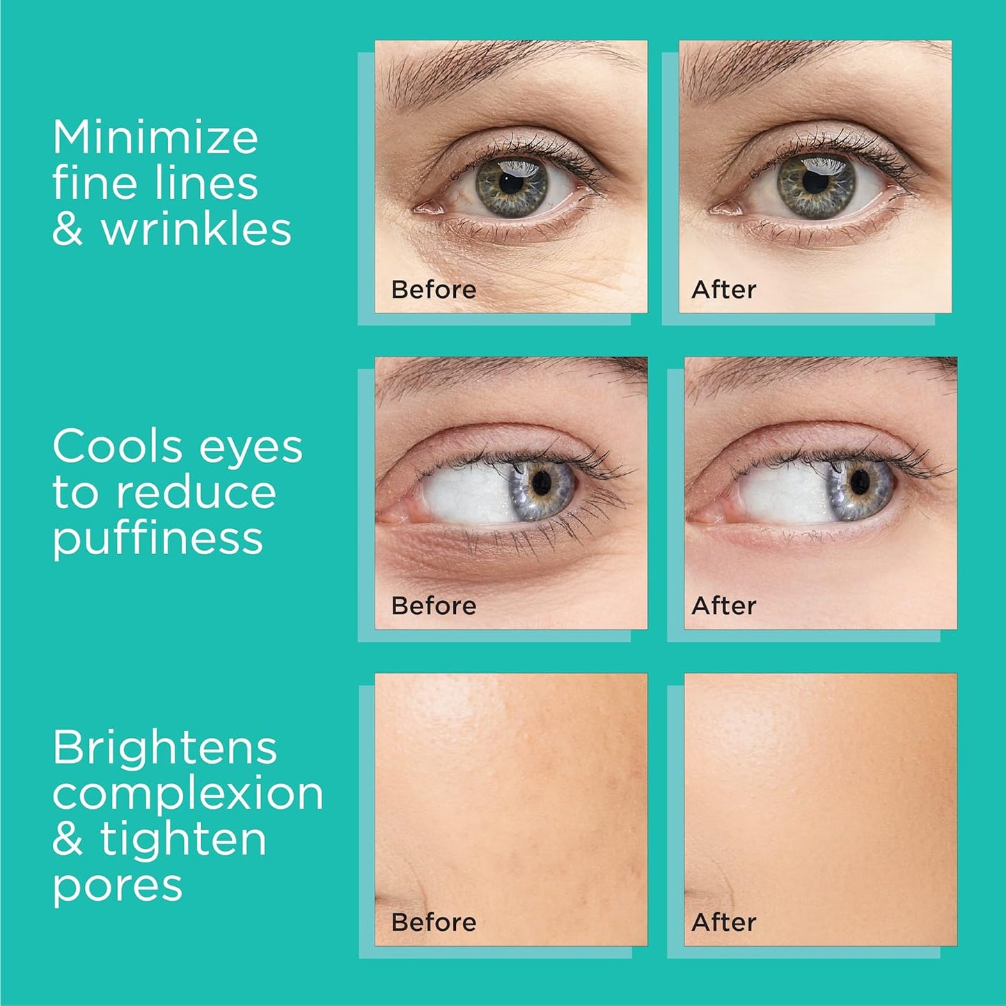 Stainless Steel Ice Globes for Facials (Gold Black Handle), Durable Cryo Globes Instantly Reduce Puffiness, Tighten Pores & Sinus Relief, Face Globes Facial Massages & Daily Beauty Routine