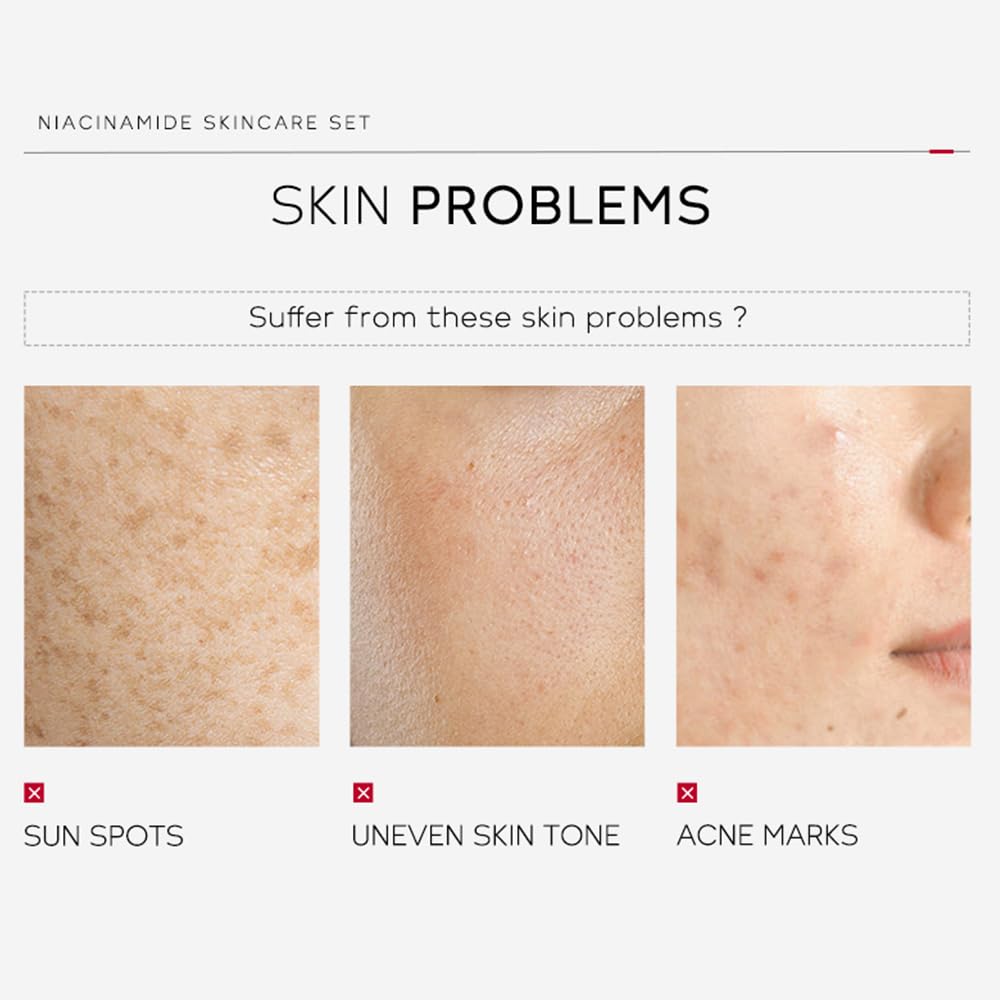 Niacinamide Skincare Set: 4pcs Beauty Kit with Cleanser, Toner, Serum, & Facial Cream - Hydrates & Evens Skin Tone - TSA-Friendly Travel Sizes, Perfect Gift for Women, Moms, & Teens