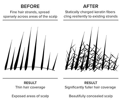 Hair Building Fiber Concealer, 28 gm (Natural Black)