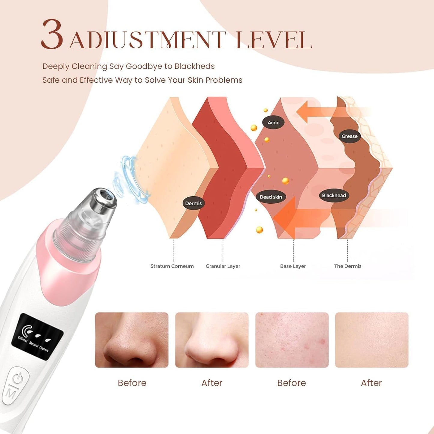 2025 Blackhead Remover Pore Vacuum,Facial Pore Cleaner-5 Suction Power,5 Probes,USB Rechargeable Blackhead Vacuum Kit Electric Acne Extractor Tool for Adult