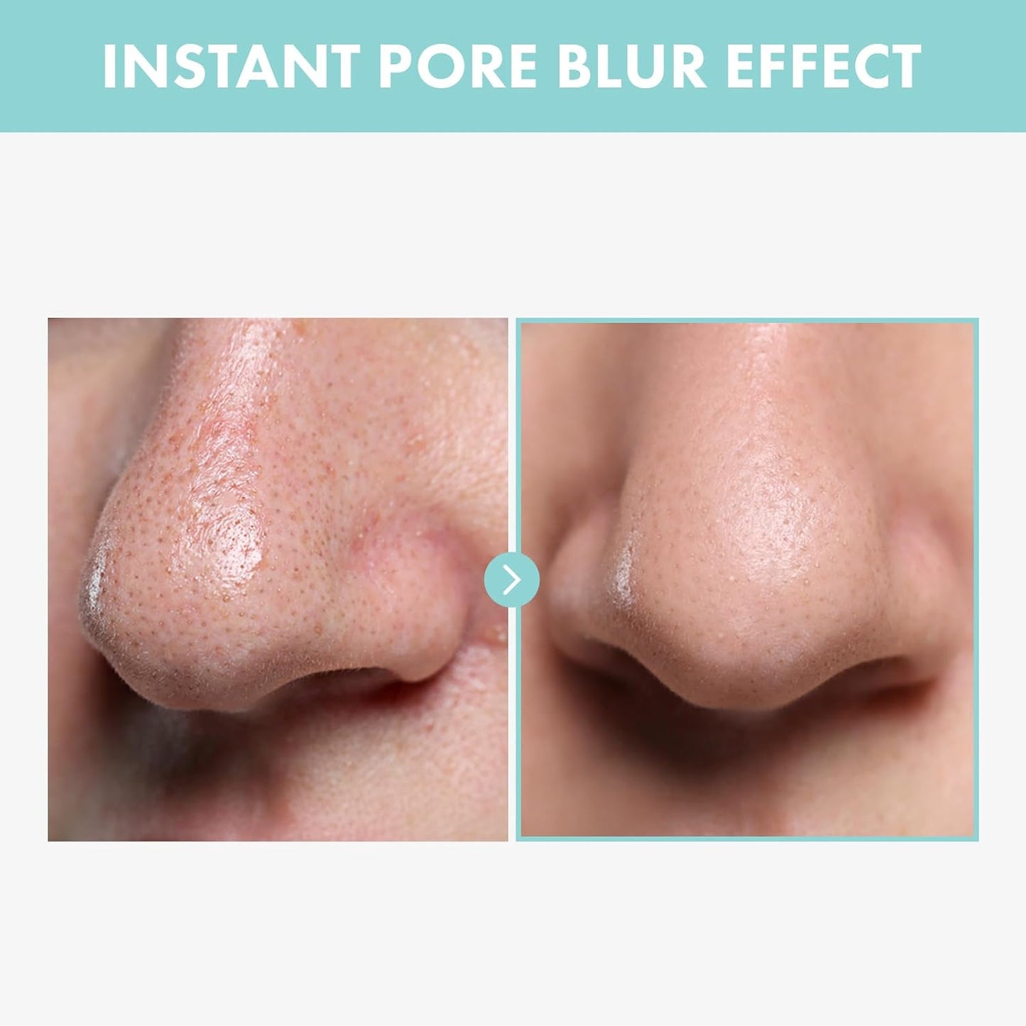 Pore Tightening Serum, Instantly Reduces Pores, Smooths Skin & Strengthens Barrier, Formulated With Niacinamide & Allantoin, Pore Minimizer For Face, Korean Skin Care, 30ml, 1.01 fl. oz.