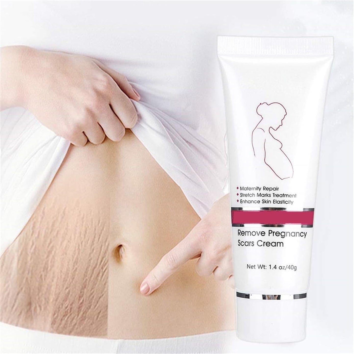 RtopR Stretch Marks and Scar Cream,Crema para Estrias De Embarazo,Stretch Marks Postpartum Repairing Cream Wrinkles Diluting Removal Cream Crema De Cacao para Cicatrices