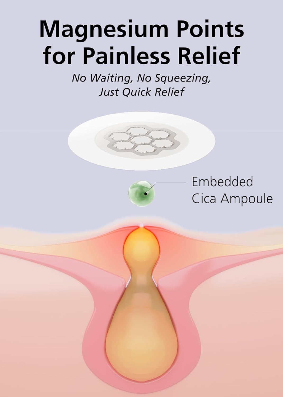 Quick Calming Magnesium Patches(20 patches) with Cica Ampoule - Intensive Care, Pimple patches, Hydrocolloid Band, Zits Spot care Overnight Home Care 2-8 hours, New boxs types