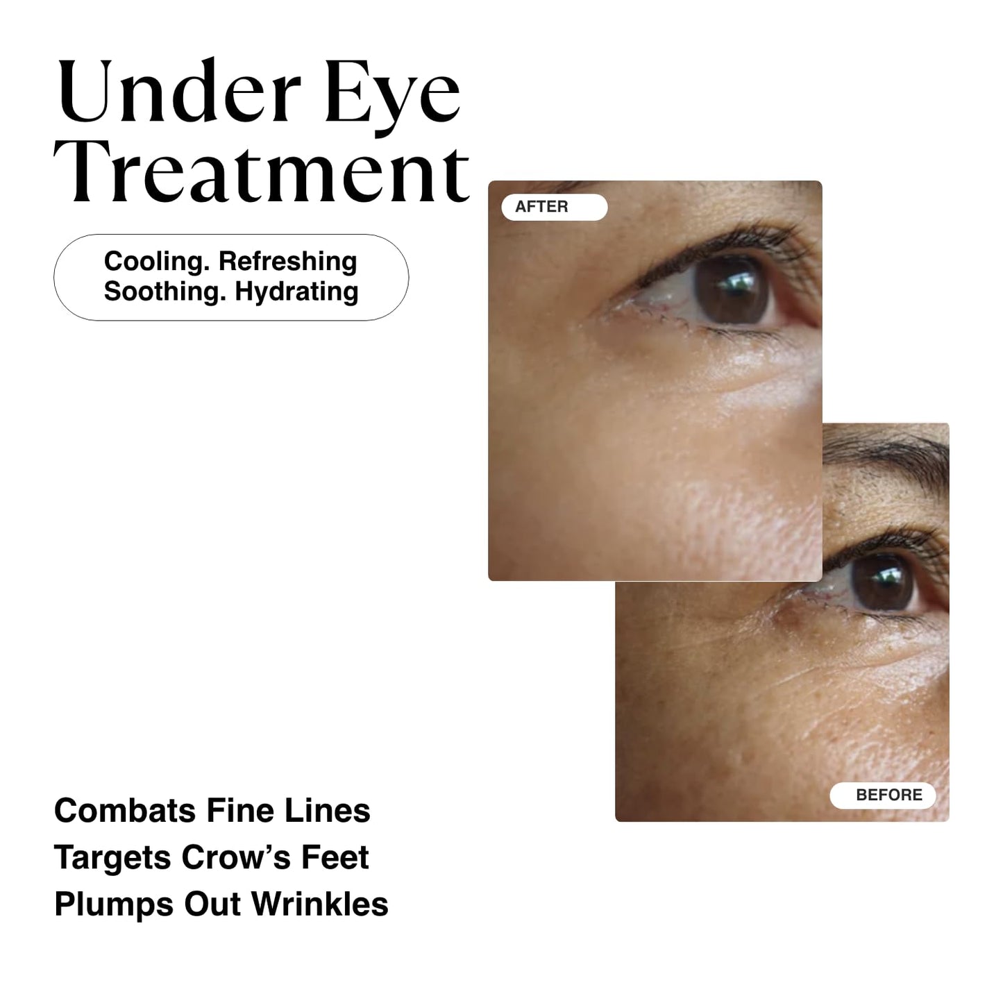 MATKAS Korean Retinol Eye Cream for Dark Circles and Puffiness, Wrinkles, Fine Lines, Night Under Eye Cream Anti Aging - Niacinamide, Turmeric Root, 6 Types of Ceramides, Hyaluronic Acid