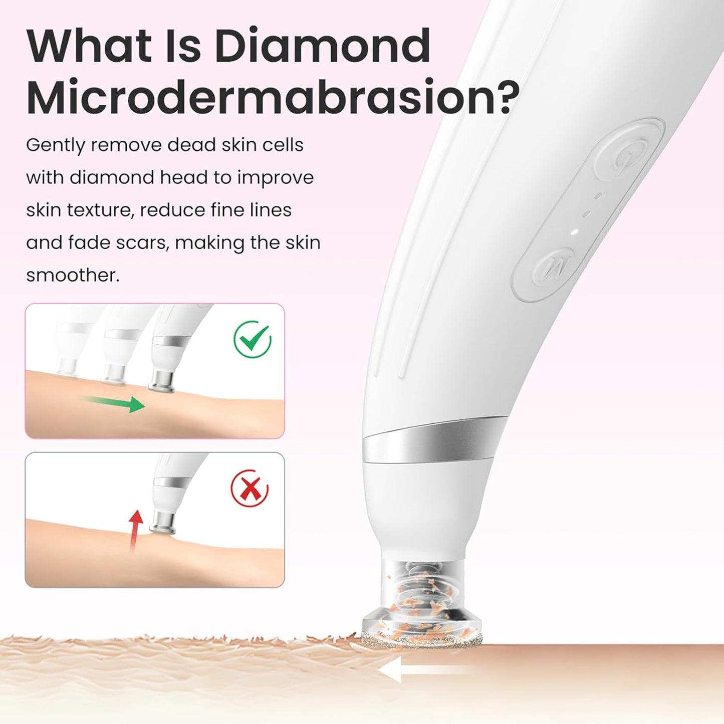 Diamond Microdermabrasion Machine, Portable Blackhead Remover Pore Vacuum, Dermabrasion Facial Machine for Exfoliation & Blackhead Removal