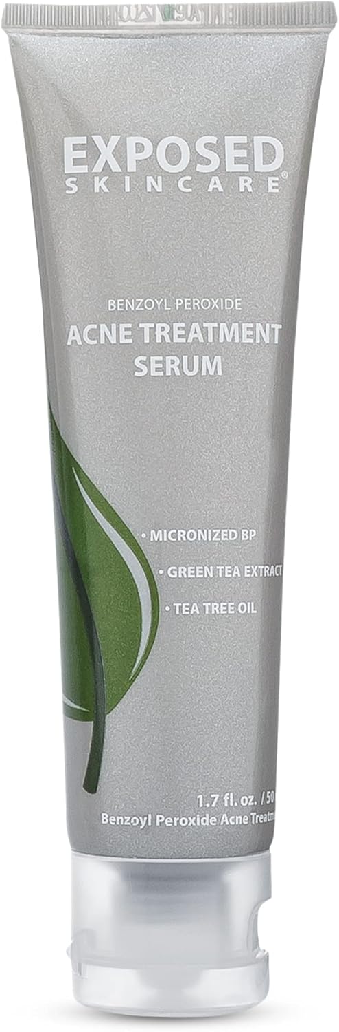 Exposed Skin Care Acne Treatment Serum Step 3 – Quickly Reduces Pimple Size and Redness - 12 Hour Spot Treatment - 3.5% Benzoyl Peroxide, Natural Green Tea & Tea Tree Oil