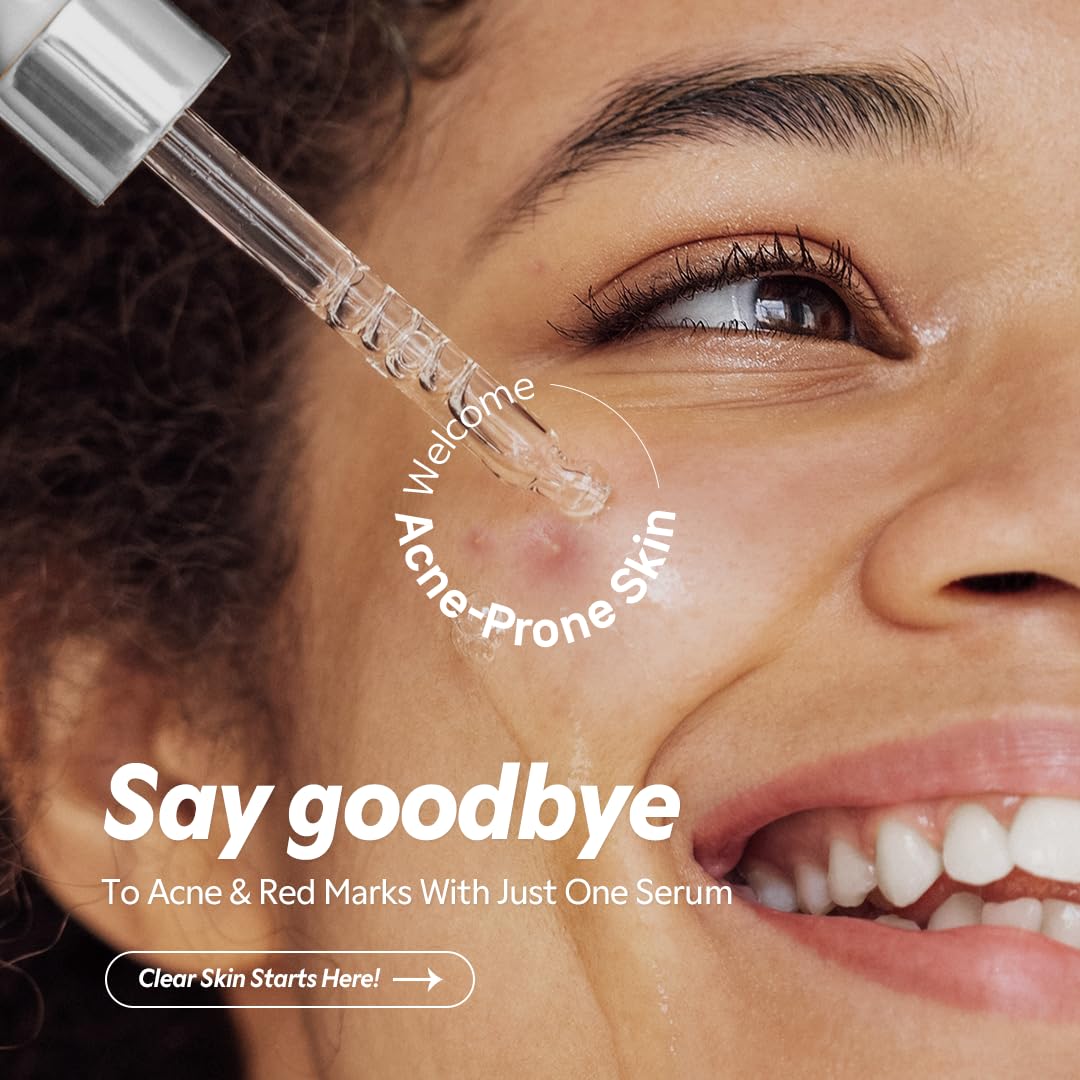 TIRTIR Azelaic Acid 12% Serum for Blemish-Prone Skin - Lightweight Hydrating Formula with Zinc PCA & Hyal-ZIP, Non-Comedogenic, Fragrance-Free, 30ml / 1.01 Fl Oz