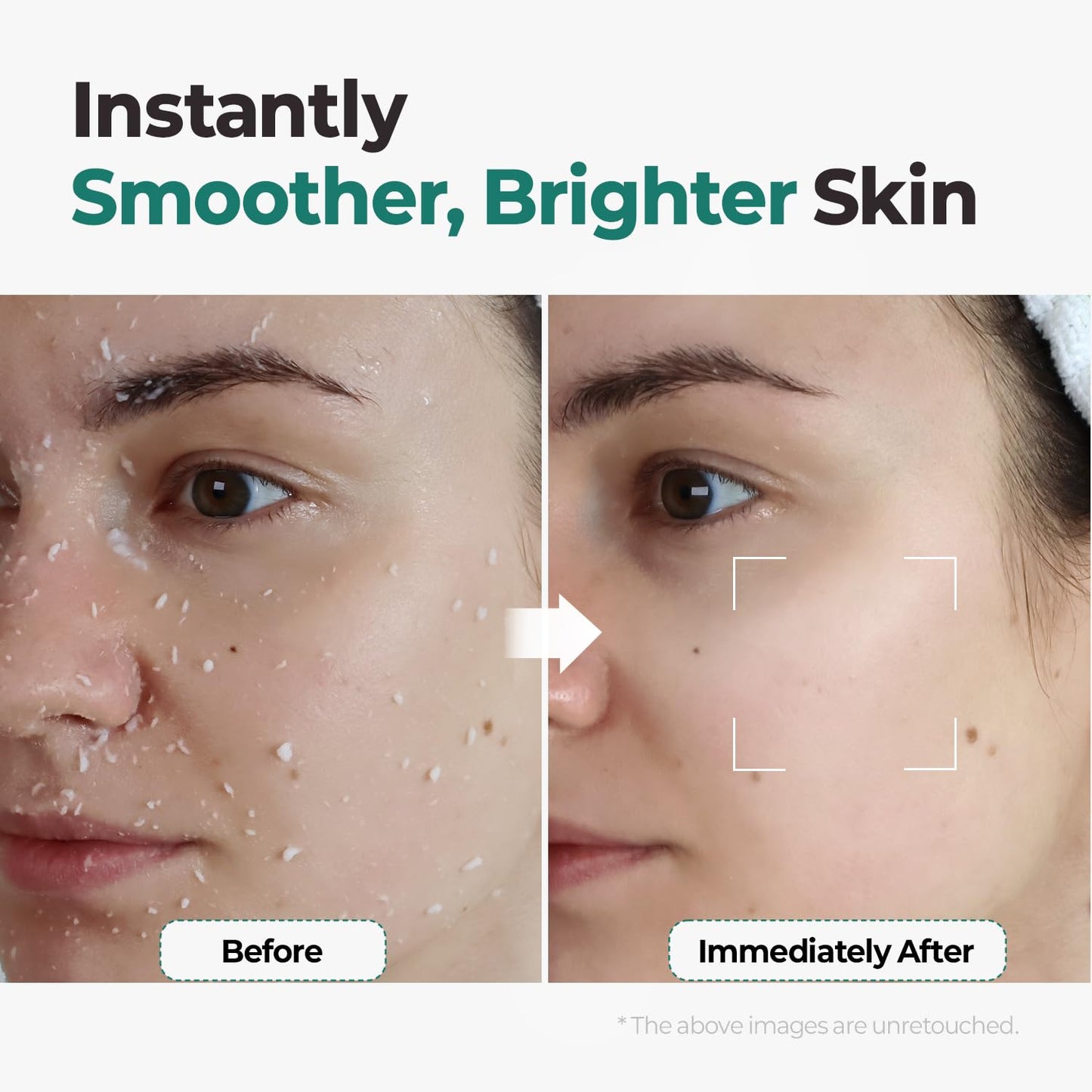 MOTHER MADE LHA Green Tea Exfoliating Aqua Peel Gel, Deep Pore Face Exfoliant, Gentle Facial Exfoliator, Dead Skin Remover, Natural Cellulose for Peeling, Vegan, Korean Skincare (100ml / 3.38 fl.oz)