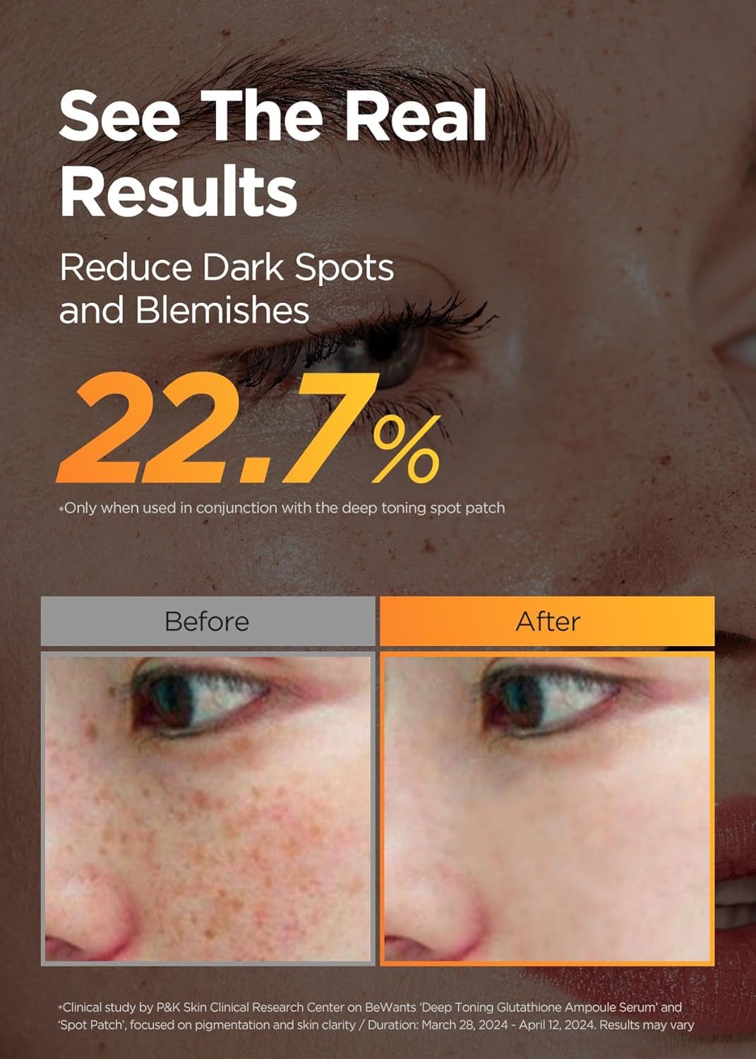 Bewants Skin Brightening Glutathione Serum, Deep Toning Complex for Even Skin Tone, with Vitamin C, Niacinamide 50,000ppm, and Dark Spot care, 1.01 fl oz (1 Pack)