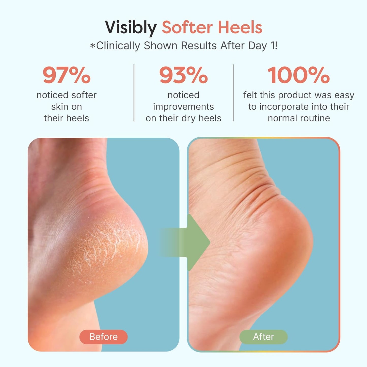 ZenToes Moisturizing Socks for Cracked Heel Treatment - Vitamin E, Olive Oil and Jojoba Oil Infused Heel Socks to Soften and Hydrate (Fuzzy Blue, Wide Width)