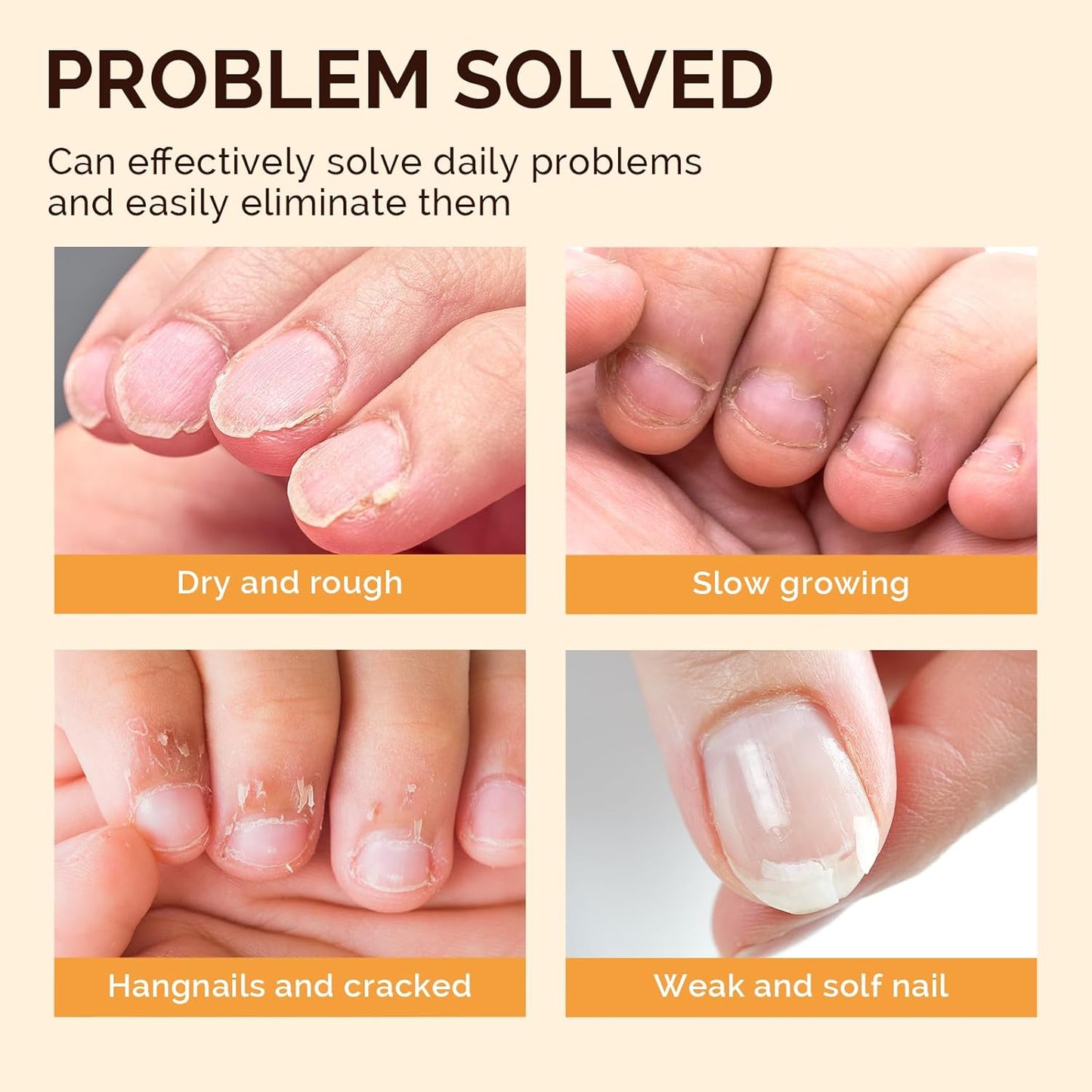 MelodySusie 6Pcs Cuticle Oil Pen Set,Nail Moisturizing Cuticle Oil Enriched with Vitamin E,Softens and Repairs Cuticles,Nail Strengthener,Protects Damaged Skin,Thin Nails,for Home and Salon Use