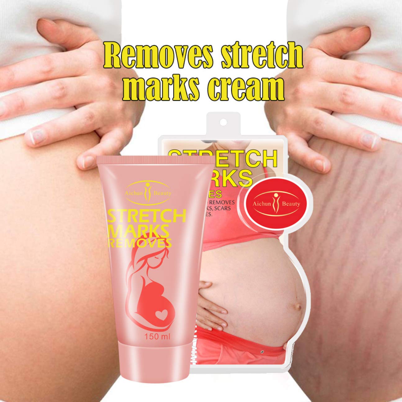 AICHUN BEAUTY Pregnancy Cream Streach Mark Remover Scars Repair Cellulites Lotion Cream 150ml