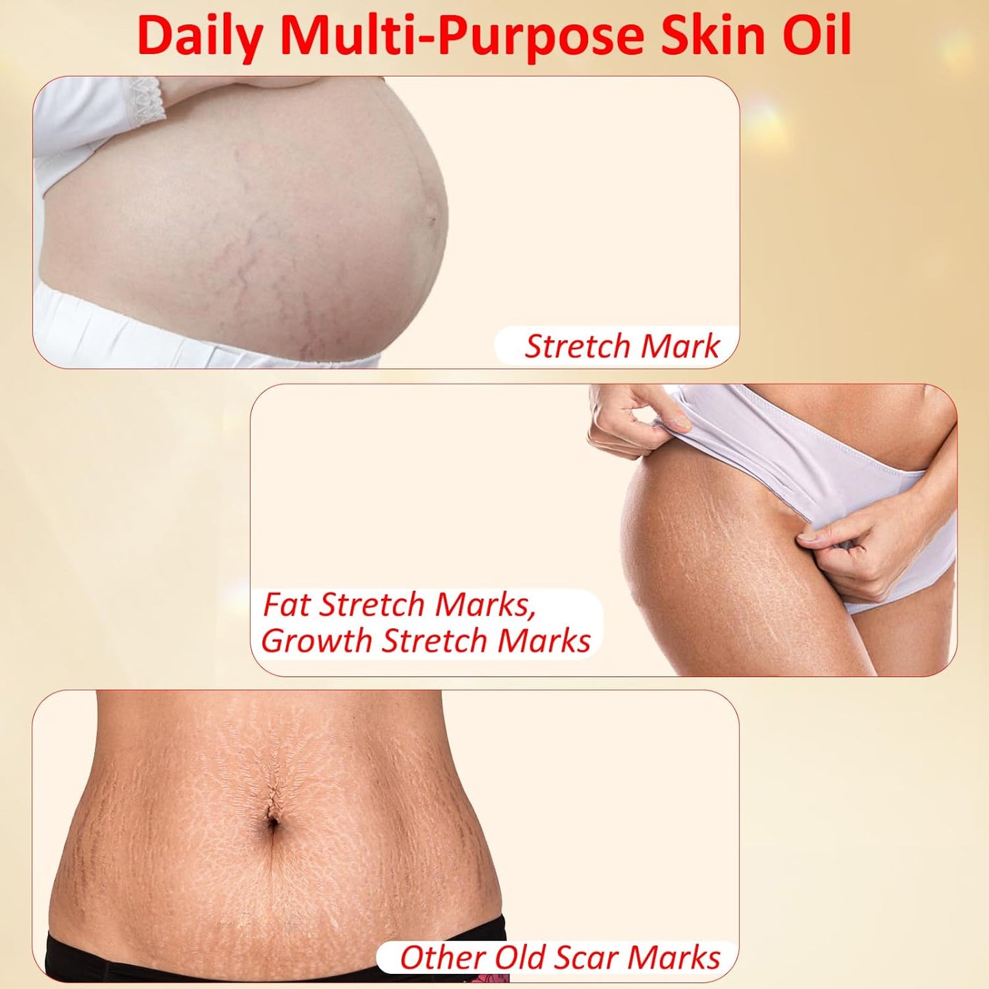Stretch Mark Oil for Pregnancy, Skincare Body Oil for Scars and Stretchmarks, Pregnancy Oils for Stretch Marks Pre and Postpartum Natural Skincare Massage Oil, Skin Regenerate Oil, 4.2 fl.oz