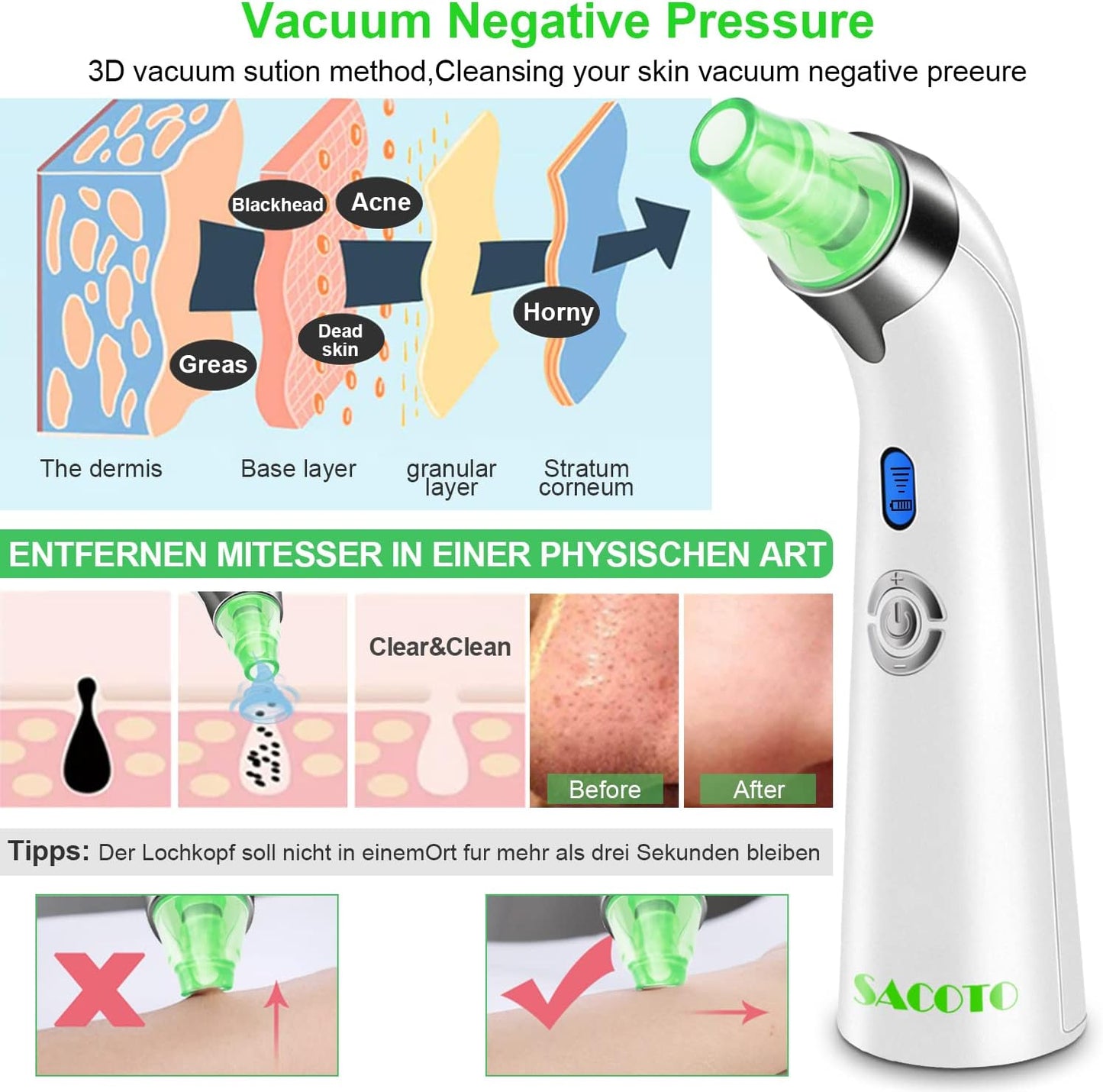 Blackhead Remover Pore Vacuum, Face Suction Pore Cleanser, 5 Suction Power Electric Blackhead Extractor Tool, 4 Probes, Blackhead Suction Remover for Women & Men