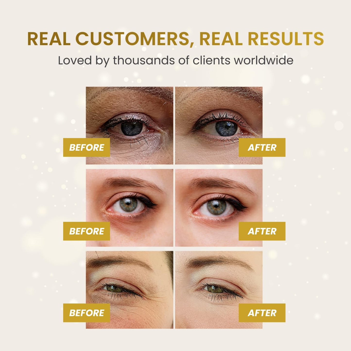 PLANTIFIQUE Gold Eye Patches for Puffy Eyes | 20 Pairs | Gifts | Under Eye Masks for Dark Circles | Puffiness Eye Gels | Eye Mask Skincare