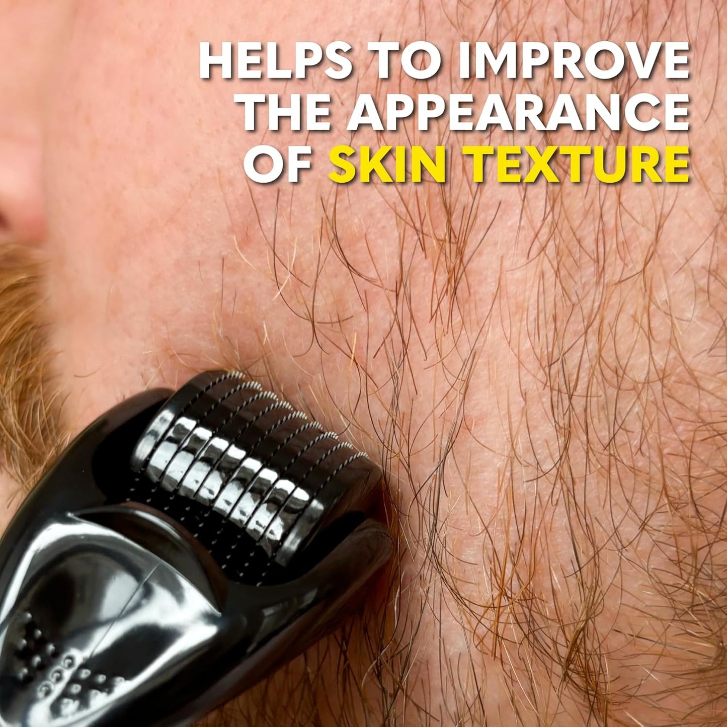 The Beard Club Derma Roller for Face, Body and Scalp - Microneedling for Men and Women with 540 Titanium Microneedles - Beard Roller & Micro Needling Scalp Hair - Yellow & Black