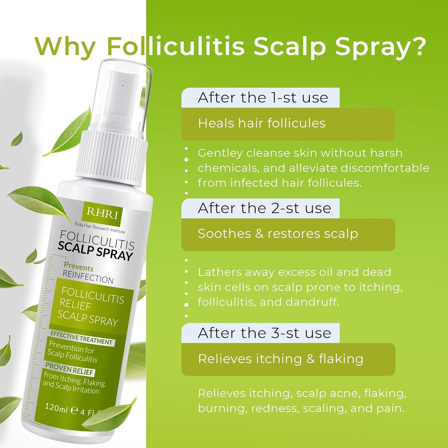 Folliculitis Scalp Spray | Dandruff Treatment for Dandruff, Psoriasis & Folliculitis | Antifungal & Anti Dandruff Itchy Scalp Treatment Formula Spray for Dry and Irritated Scalp
