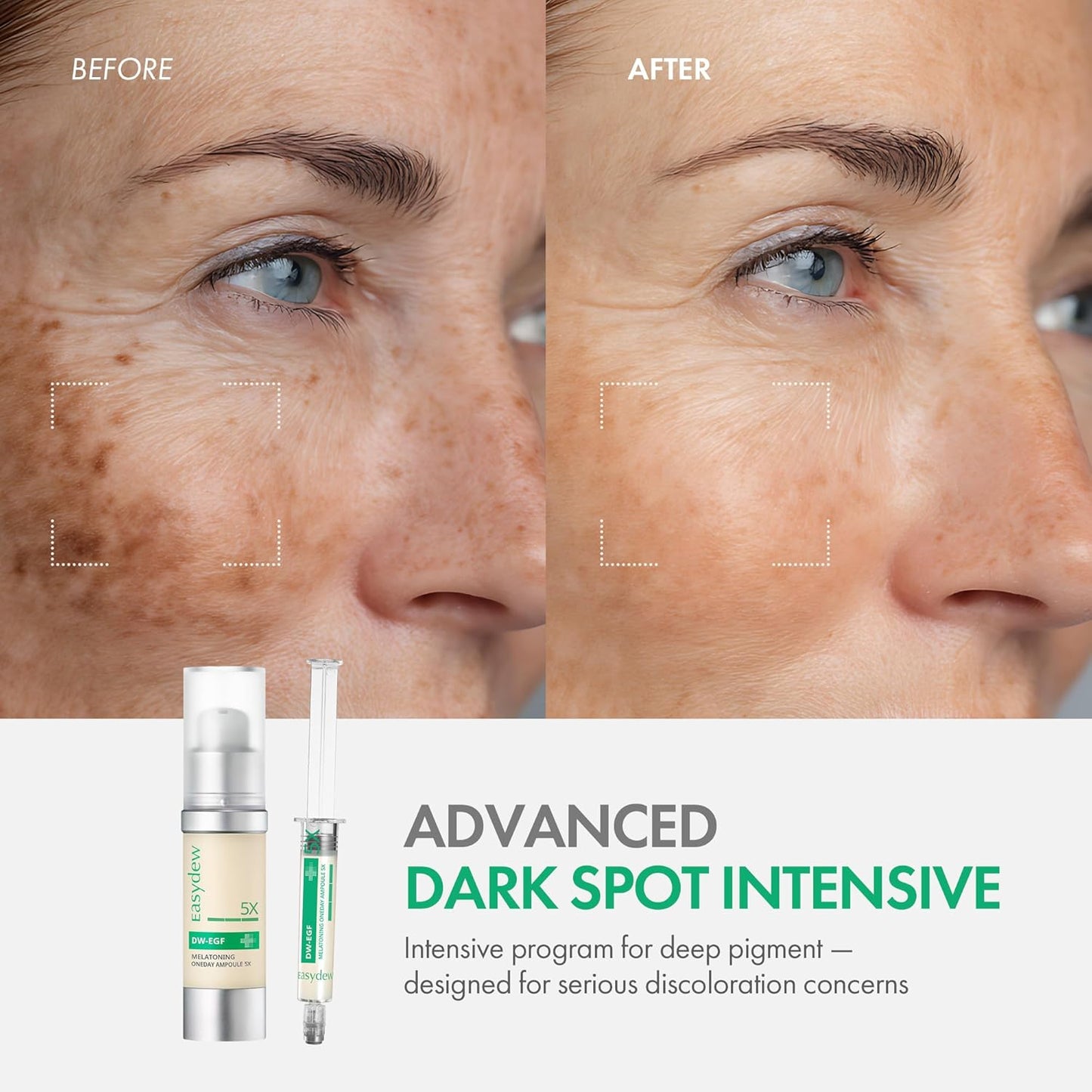 Easydew DW-EGF Melatoning Ampoule 5X - Hydrating Dark Spot Serum with Niacinamide & Glutathione for Uneven Skin - Fast Absorbing Day & Night Ampoule Korean Skin Care (Pump 0.27 fl oz, EGF 5X)