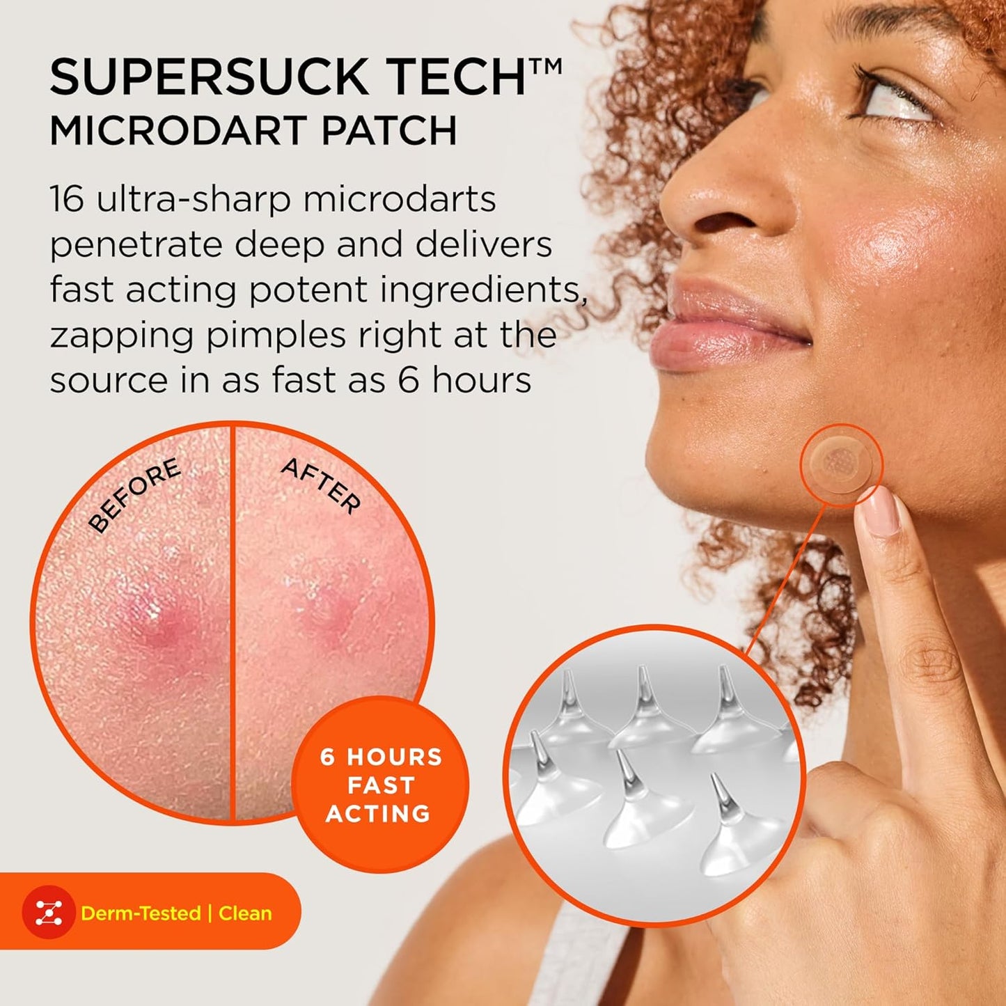 ZitSticka Killa Pimple Patches for Face - World's Most Potent Pimple Patch with Fast-Acting Microdarts - Starts Working within 6 Hours for Deep, Early-Stage Zits - Mini 4 Count