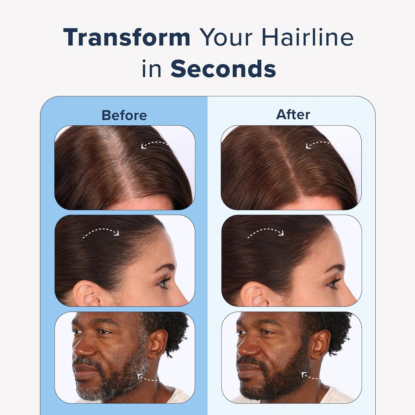 TRUHAIR Color & Conceal Waterproof Root Touch Up - Hair Cover Up for Gray Coverage and Hairline Filling - 11 Colors Available (Blonde)