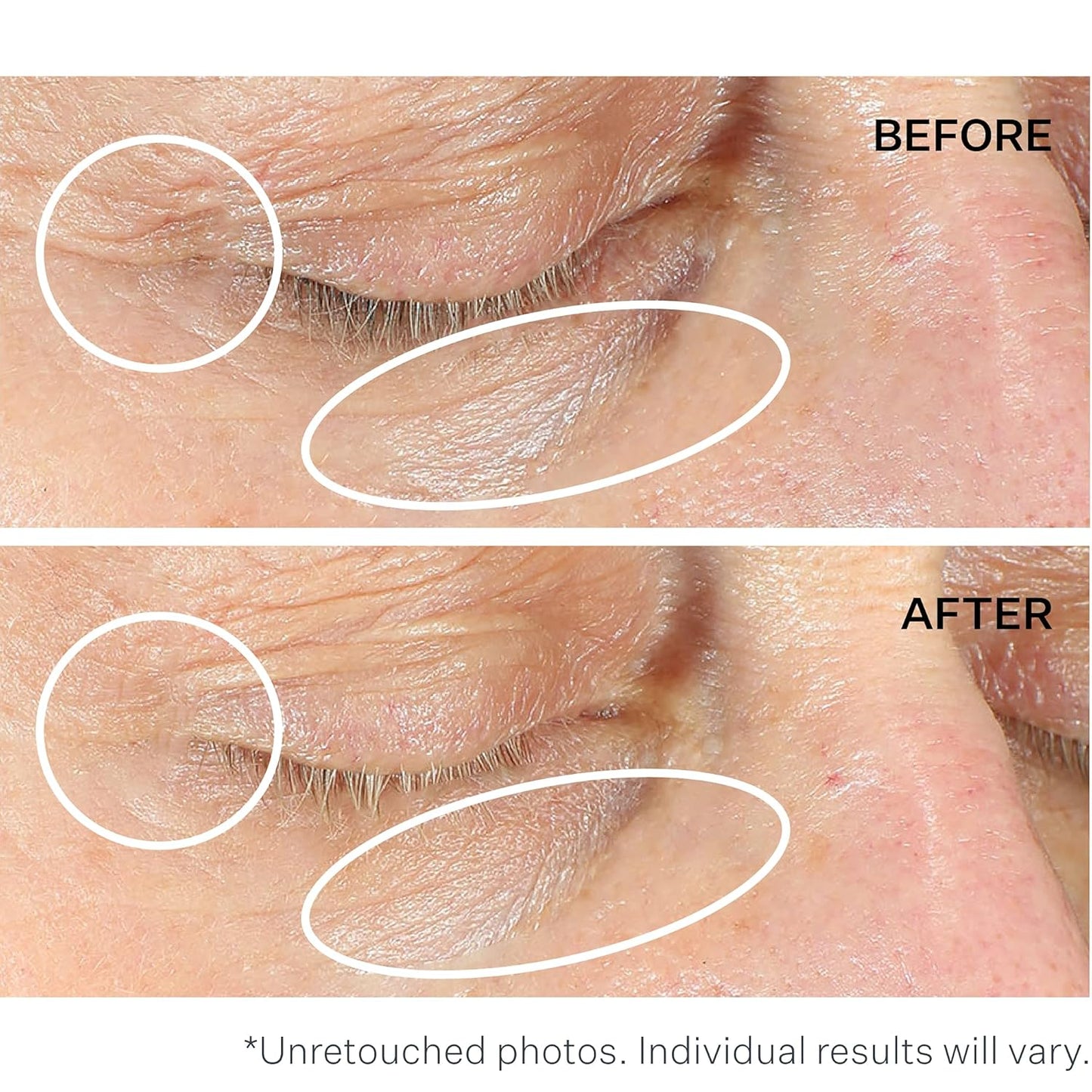 StriVectin Anti-Wrinkle Intensive Eye Cream Concentrate for Wrinkles PLUS, Targets Crow's Feet, Firmness, Puffiness & Dark Circles, 1 Fl oz