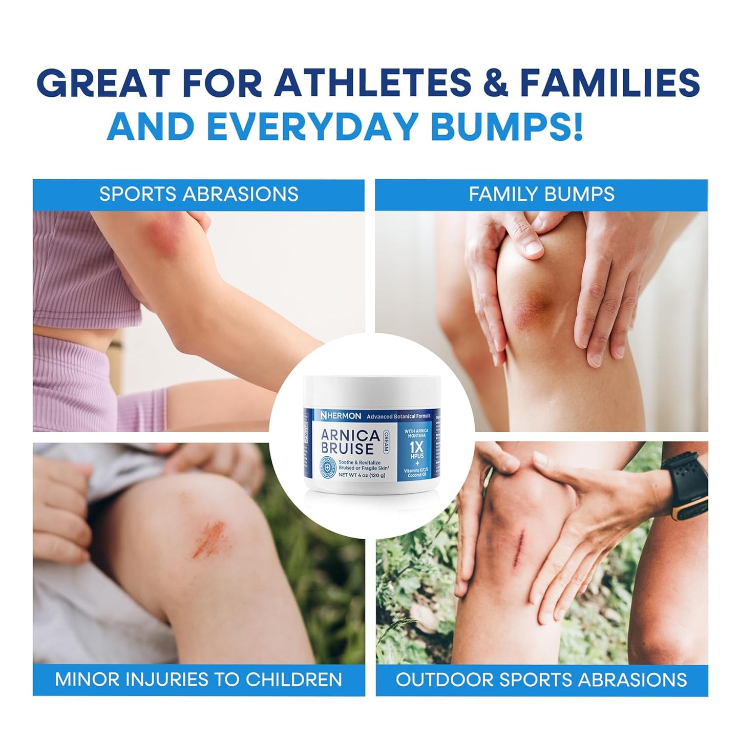 Hermon Arnica Bruise Cream Extra Strength: Fast-Acting for Bruising & Swelling on Thin Skin - High Strength Arnica Montana with Vitamins K, C & E–Hydrating Moisturizer for Face (4 oz(pack of 2))