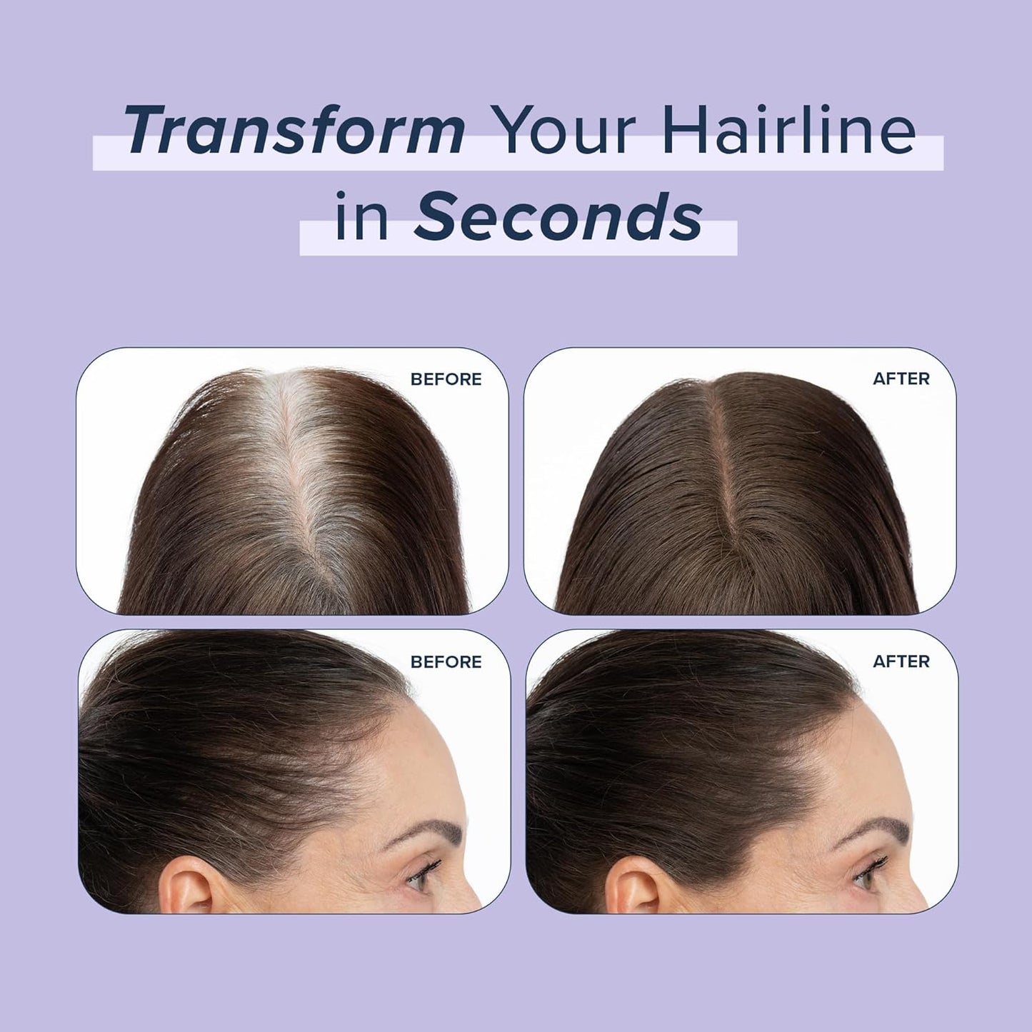 TRUHAIR Root & Scalp Cover Up Refill, Waterproof Pressed Powder for Gray Coverage, Bald Spots & Thinning Hair, Root Touch Up Color, 0.35 oz (Medium Brown)