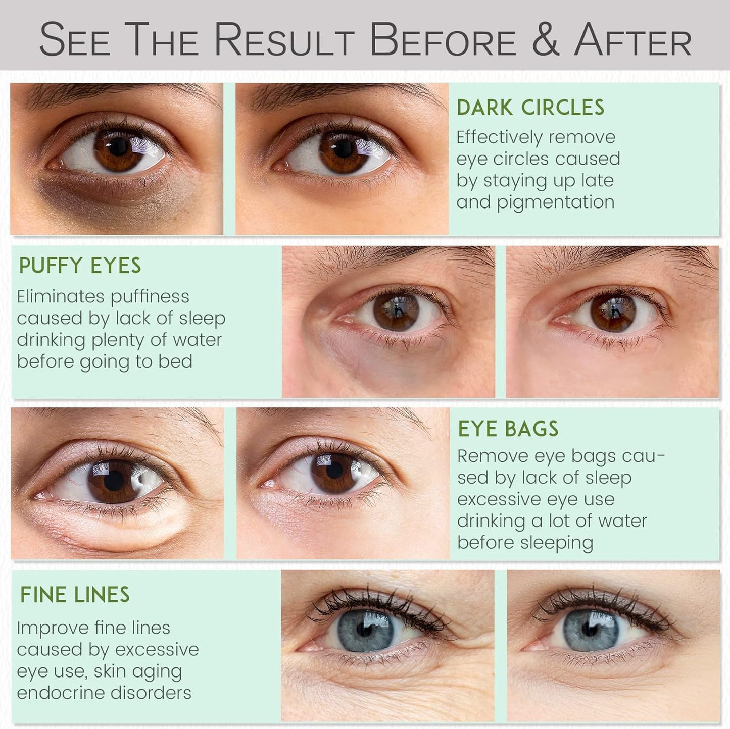 Under Eye Patches for Dark Circles and Puffiness - Under Eye Masks Anti-Aging Collagen Hyaluronic Acid, Reduce Dark Circles & Wrinkles Skincare Beauty Products for Self Care (30 Pairs)