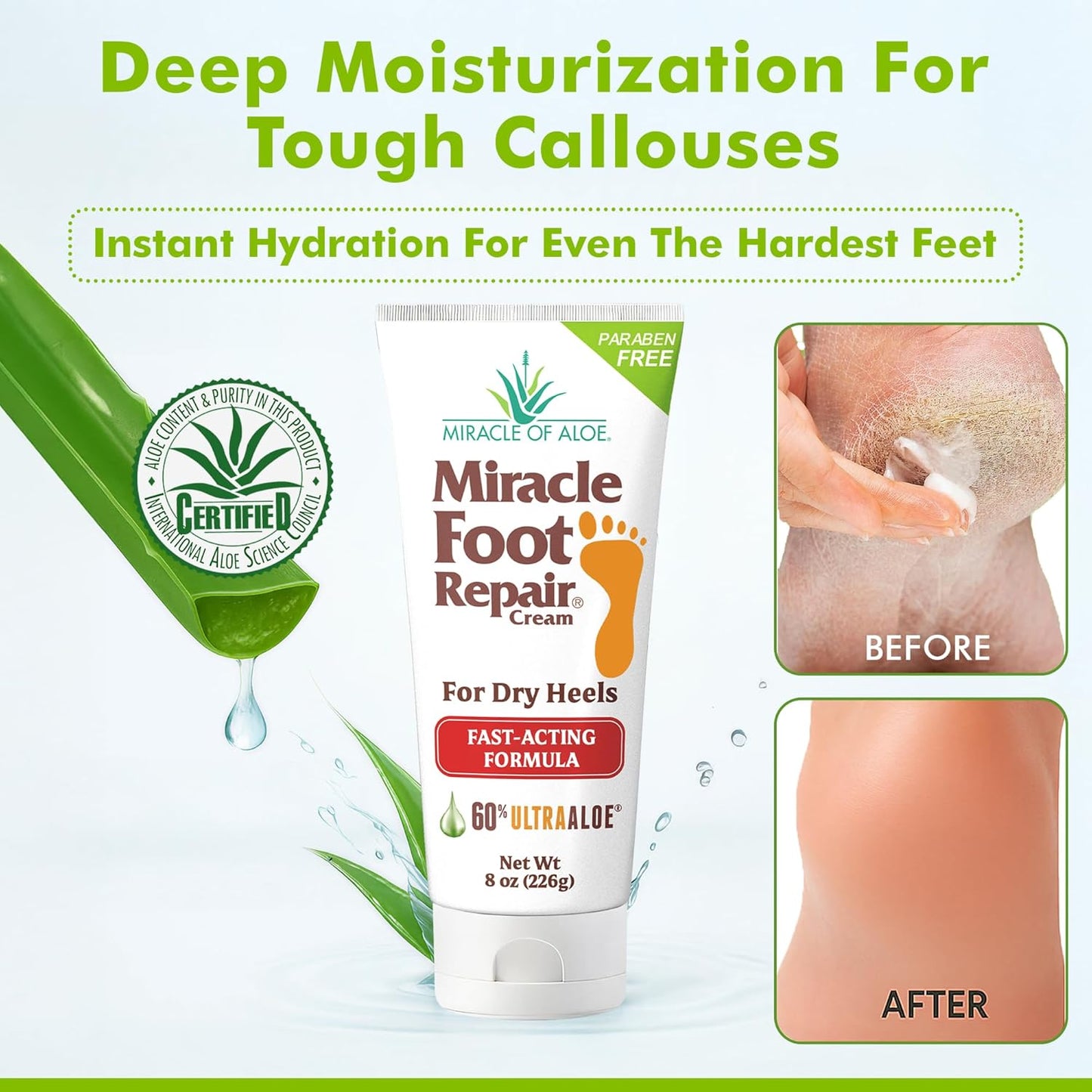 Miracle Foot Repair Cream (8 oz / 2-Pack) Repairs Dry Cracked Heels and Feet, 60% Pure UltraAloe Moisturizes, Softens, and Repairs