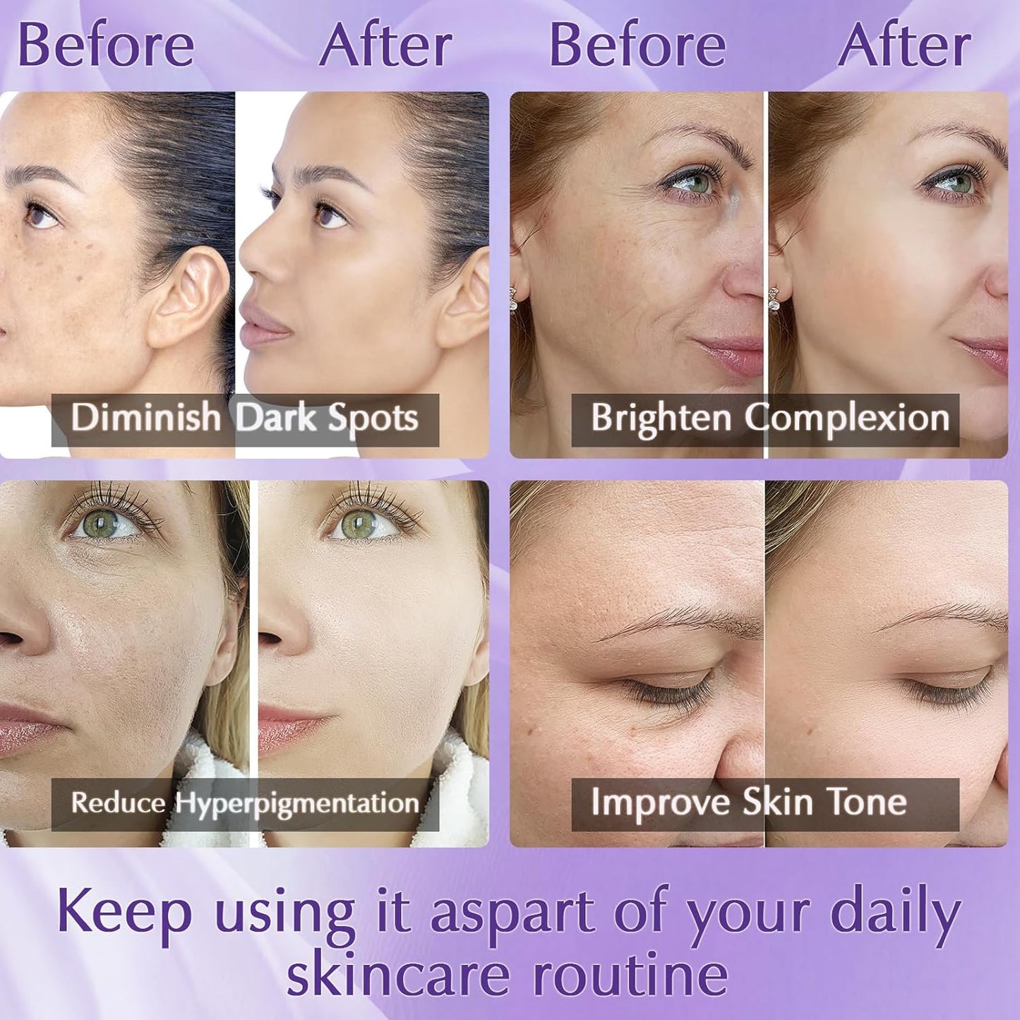 Dark Spot Remover for Face Cream, Dark Spot Corrector, Rapid Tone Repair Retinol Serum for Sun Spots, Age Spots, Skin Brown, Melasma Skin Care with Upgraded Formula Vitamin C for Women 1.7 Fl OZ