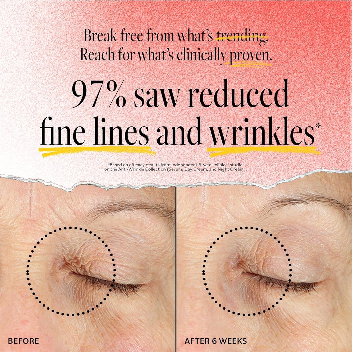 DERMA E Face Serum, Anti Aging Regenerative Retinol Serum for Face, 1 Fl Oz, Vitamin A, Bakuchiol, Glycolic Acid, Green Tea Extract, Helps Reduce Appearance of Fine Lines and Wrinkles