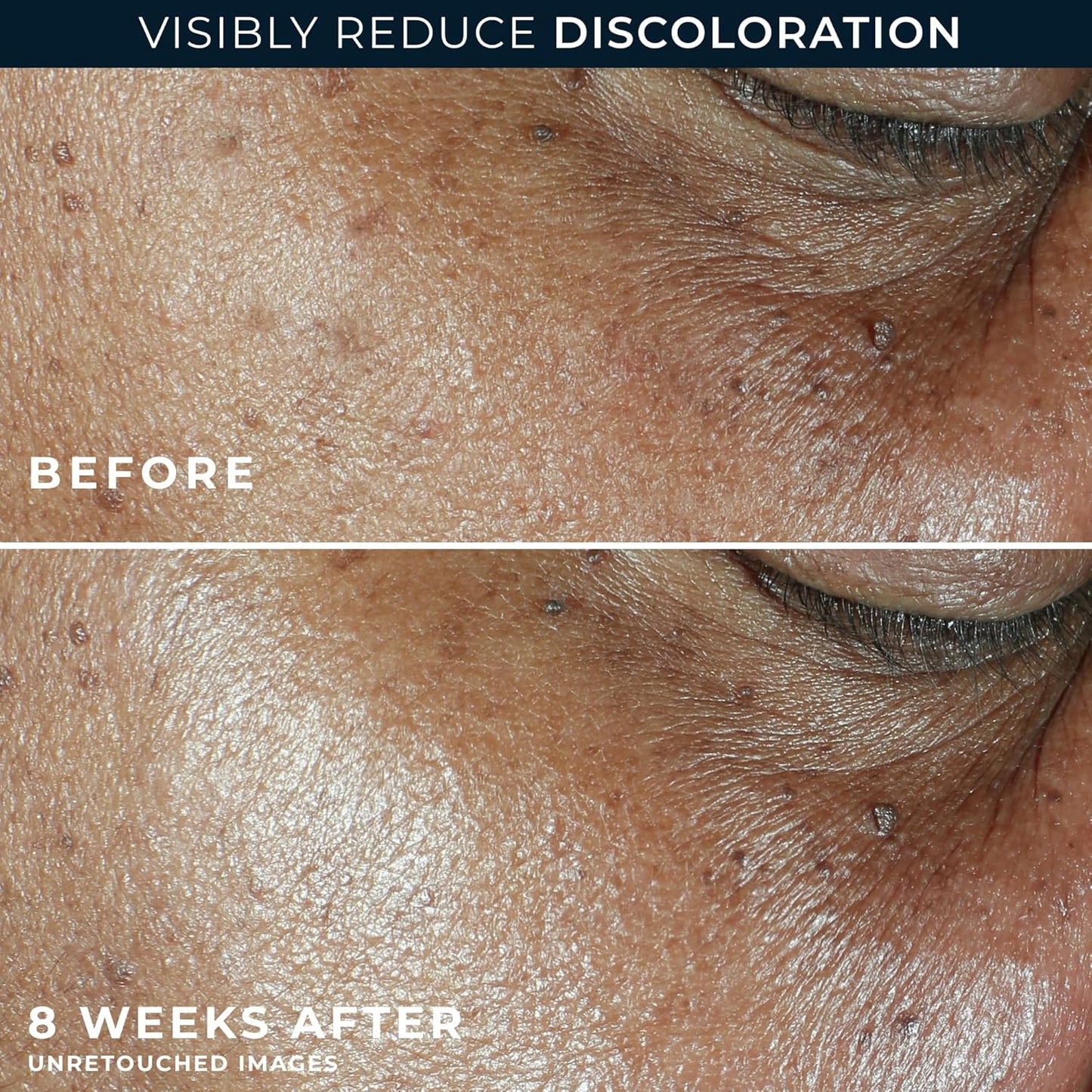 RoC Multi Correxion 5 in 1 Anti-Aging Daily Facial Moisturizer for Women and Men, Broad Spectrum SPF 30 & Shea Butter (1.7 oz) with Night Cream Packette (Packaging May Vary)